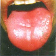 绛舌(色)